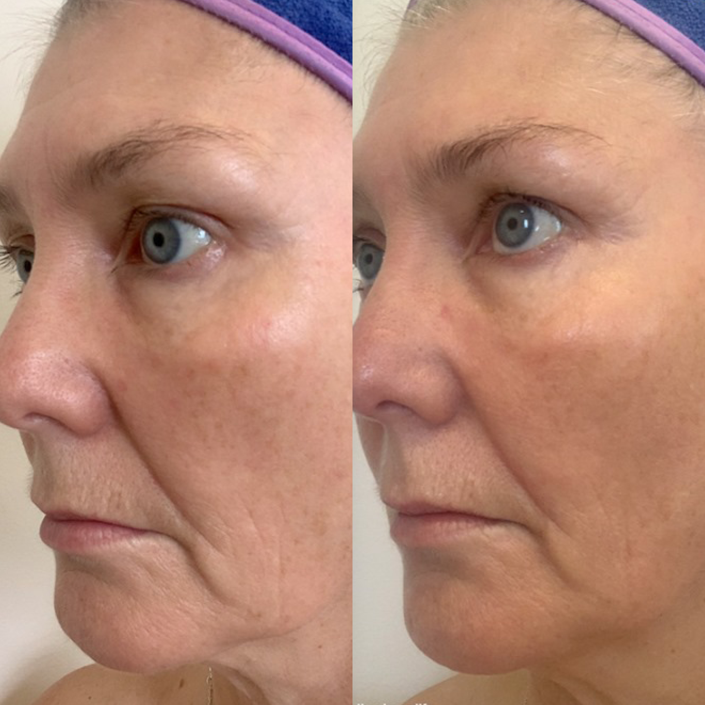 ANZ_leanne jones collagen